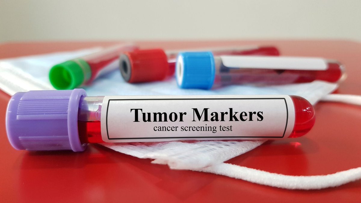 Tümor Marker